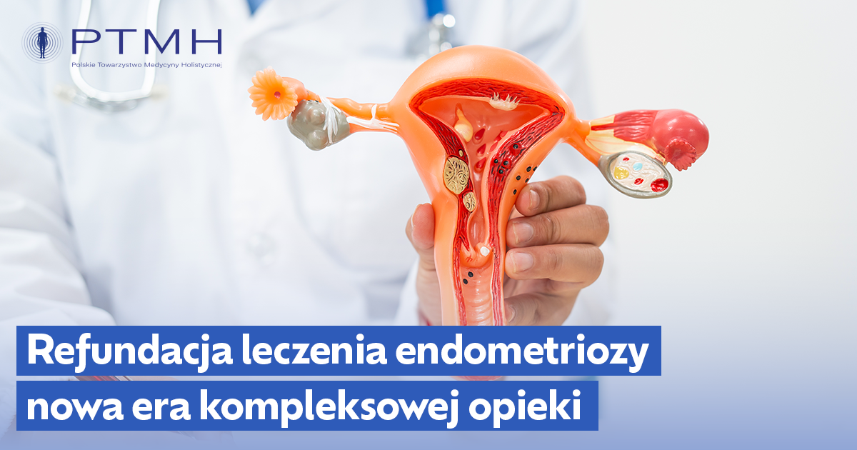 Refundacja leczenia endometriozy w Polsce od 1 lipca 2025 r. – nowa era kompleksowej opieki nad pacjentkami 1 refundacja leczenia endometriozy